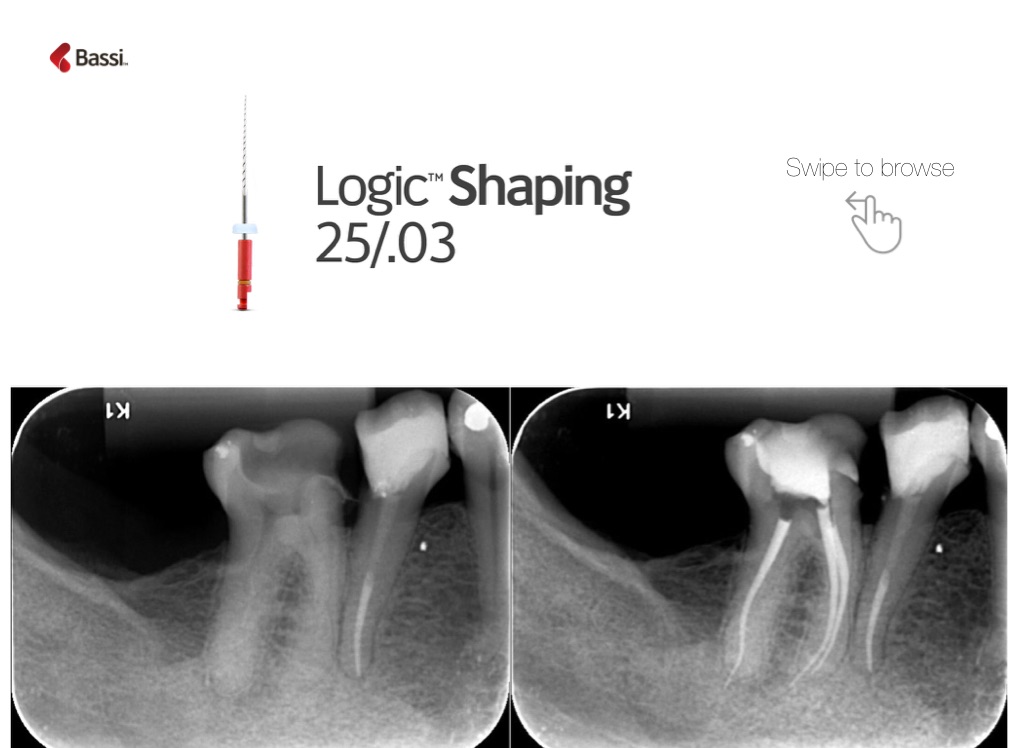 Slide 35