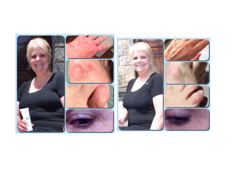 Slide 7