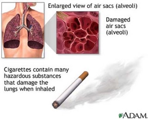how many cigarettes will damage your lungs Health - Screen 8 on FlowVella